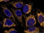 Tom22 Antibody in Immunocytochemistry (ICC/IF)