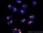 FBL Antibody in Immunocytochemistry (ICC/IF)