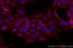NSFL1C Antibody in Immunocytochemistry (ICC/IF)