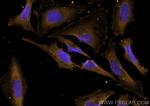 DNM2 Antibody in Immunocytochemistry (ICC/IF)