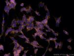 UNC13A Antibody in Immunocytochemistry (ICC/IF)
