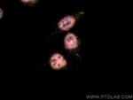 P53 Antibody in Immunocytochemistry (ICC/IF)