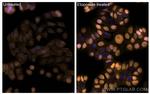 Phospho-P53 (Ser15) Antibody in Immunocytochemistry (ICC/IF)