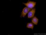 S100A6 Antibody in Immunocytochemistry (ICC/IF)