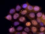 CDK4 Antibody in Immunocytochemistry (ICC/IF)