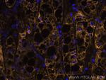 ASGR1 Antibody in Immunohistochemistry (Paraffin) (IHC (P))