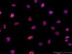 Cyclin E2 Antibody in Immunocytochemistry (ICC/IF)