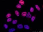 HDAC2 Antibody in Immunocytochemistry (ICC/IF)