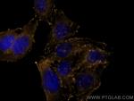 VASP Antibody in Immunocytochemistry (ICC/IF)