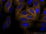HLA class I ABC Antibody in Immunocytochemistry (ICC/IF)