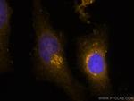 GS28 Antibody in Immunocytochemistry (ICC/IF)