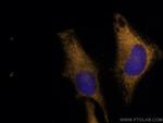 p130Cas Antibody in Immunocytochemistry (ICC/IF)