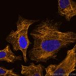 Cytokeratin 17 Antibody in Immunocytochemistry (ICC/IF)