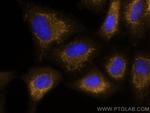 BCL10 Antibody in Immunocytochemistry (ICC/IF)