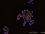 ITK Antibody in Immunocytochemistry (ICC/IF)