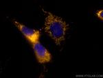 C1QBP Antibody in Immunocytochemistry (ICC/IF)
