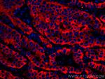 pan-keratin Antibody in Immunohistochemistry (Paraffin) (IHC (P))