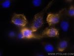 Cytokeratin 5 Antibody in Immunocytochemistry (ICC/IF)