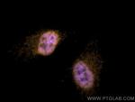 ERK1/2 Antibody in Immunocytochemistry (ICC/IF)