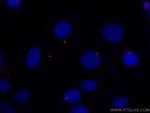 acetylated Tubulin (Lys40) Antibody in Immunocytochemistry (ICC/IF)