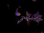 Calretinin Antibody in Immunocytochemistry (ICC/IF)