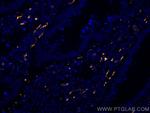 Calretinin Antibody in Immunohistochemistry (Paraffin) (IHC (P))