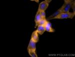 Bcl2 Antibody in Immunocytochemistry (ICC/IF)