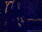 Endoglin/CD105 Antibody in Immunohistochemistry (Paraffin) (IHC (P))