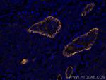Endoglin/CD105 Antibody in Immunohistochemistry (Paraffin) (IHC (P))