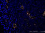Endoglin/CD105 Antibody in Immunohistochemistry (Paraffin) (IHC (P))