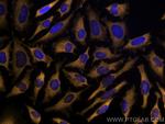LARS Antibody in Immunocytochemistry (ICC/IF)