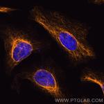 Vimentin Antibody in Immunocytochemistry (ICC/IF)
