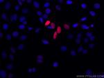 P21 Antibody in Immunocytochemistry (ICC/IF)