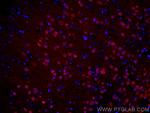 PCP4 Antibody in Immunohistochemistry (PFA fixed) (IHC (PFA))