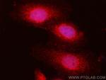 PSMB8 Antibody in Immunocytochemistry (ICC/IF)