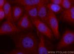 NLRX1 Antibody in Immunocytochemistry (ICC/IF)