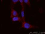 C1QBP Antibody in Immunocytochemistry (ICC/IF)