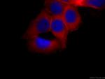 Annexin A2 Antibody in Immunocytochemistry (ICC/IF)
