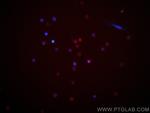 CXCR3B Antibody in Immunocytochemistry (ICC/IF)