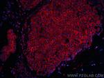 RRM1 Antibody in Immunohistochemistry (PFA fixed) (IHC (PFA))