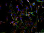 ITM2C Antibody in Immunocytochemistry (ICC/IF)