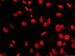 FUS/TLS Antibody in Immunocytochemistry (ICC/IF)