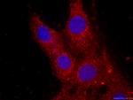 CKM-Specific Antibody in Immunocytochemistry (ICC/IF)