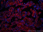 CD34 Antibody in Immunohistochemistry (PFA fixed) (IHC (PFA))