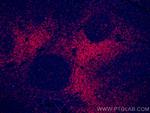 CD3 Antibody in Immunohistochemistry (PFA fixed) (IHC (PFA))