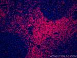 CD3 Antibody in Immunohistochemistry (PFA fixed) (IHC (PFA))