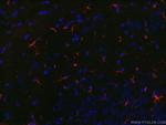 GFAP Antibody in Immunohistochemistry (PFA fixed) (IHC (PFA))