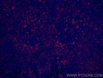 CD11c/Integrin alpha X Antibody in Immunohistochemistry (PFA fixed) (IHC (PFA))