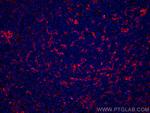 CD11c/Integrin alpha X Antibody in Immunohistochemistry (PFA fixed) (IHC (PFA))