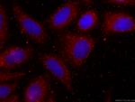 FAM3C Antibody in Immunocytochemistry (ICC/IF)